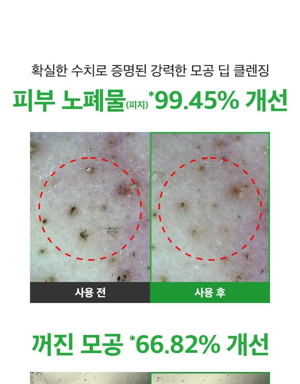 [모공딥클렌징] 성분에디터 그린토마토 딥 포어 클렌징 울트라 휘핑 폼 120g 상세페이지 5